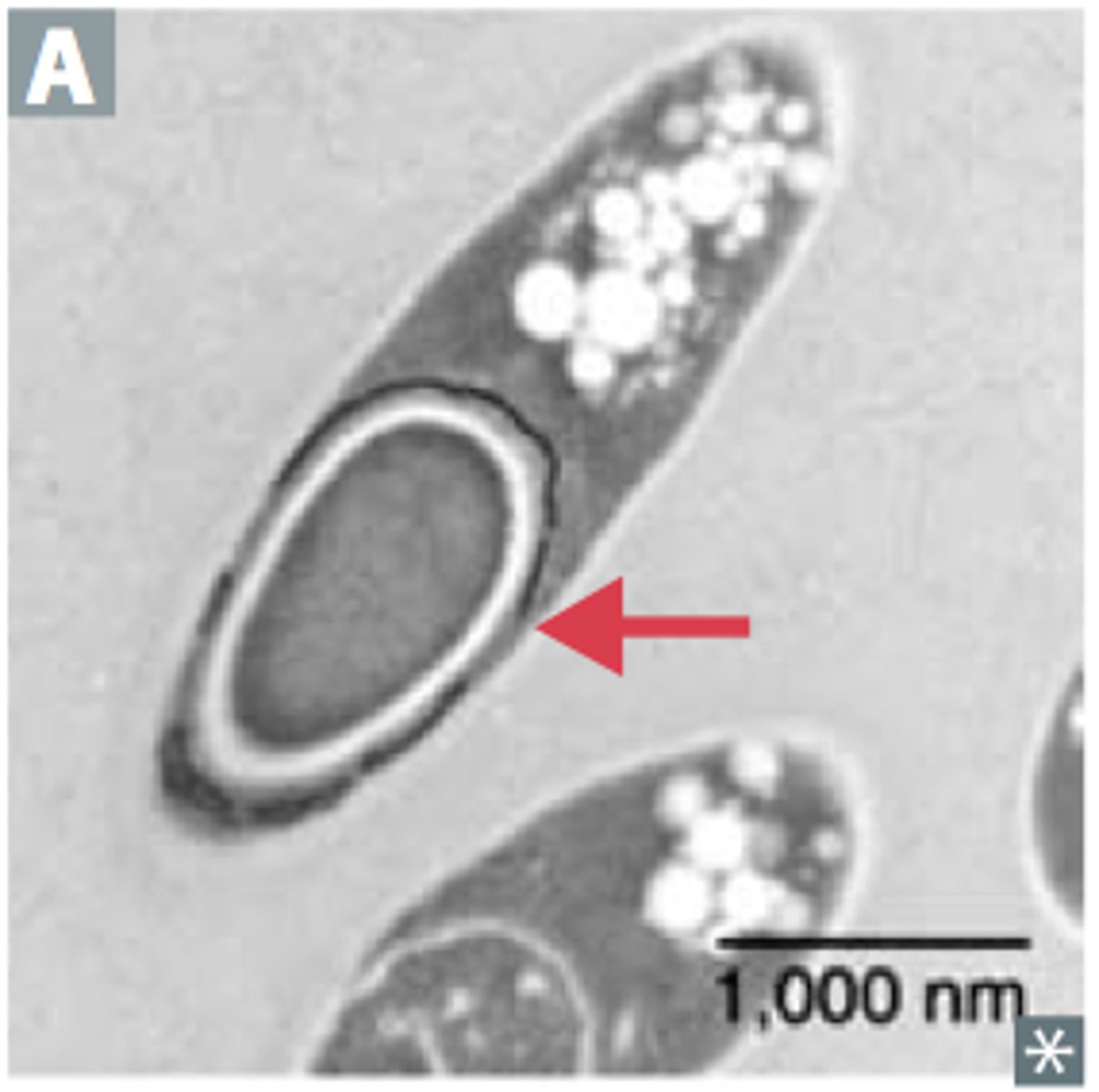 <p>Clostridium spp.</p>