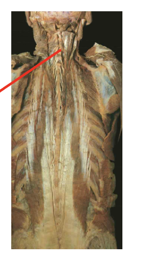 <p>What is this muscle. What is its origin. Where does it inserts. </p>