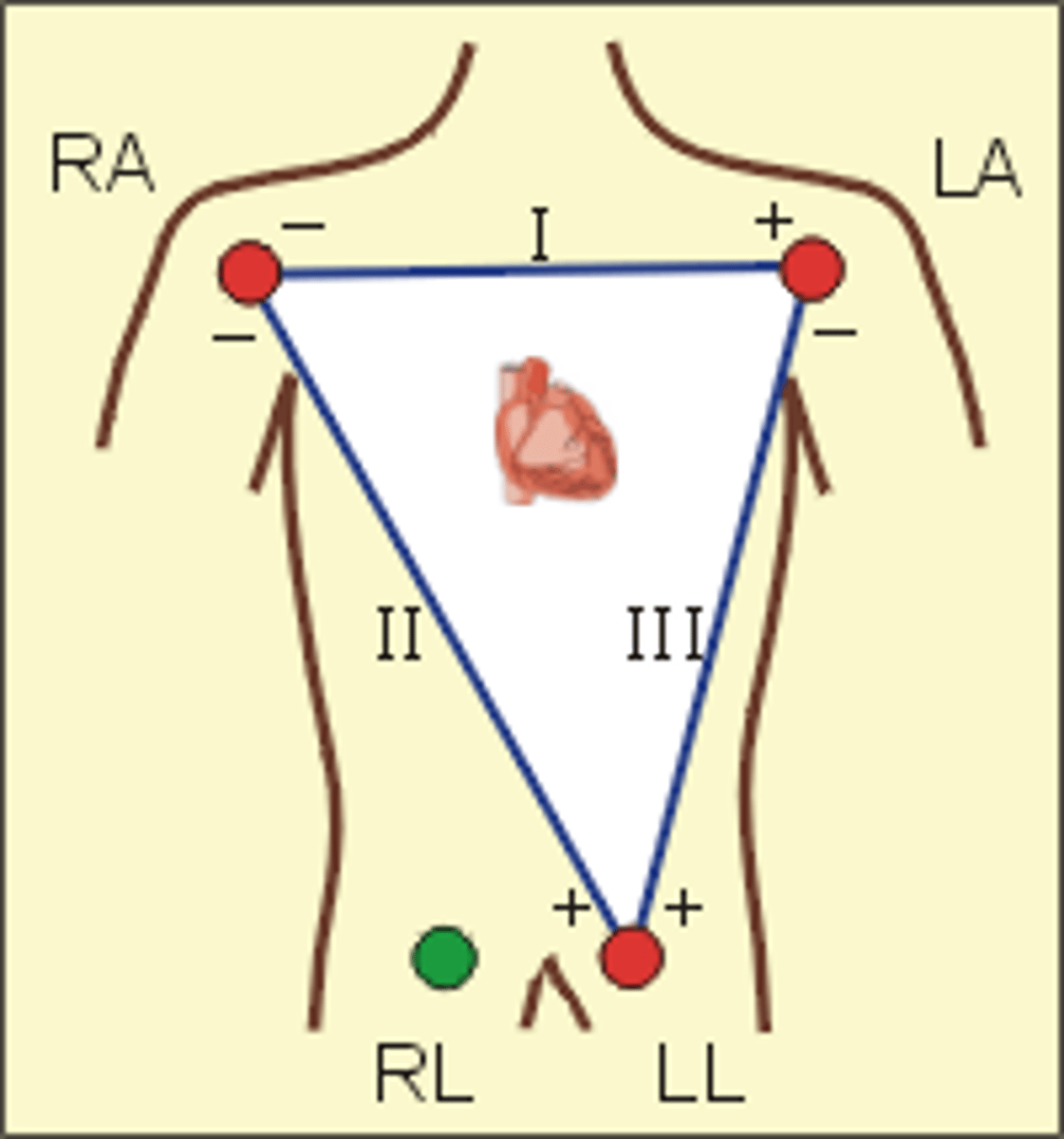 <p>the triangle around the heart formed by the bipolar limb leads</p><p>shape forms an inverted triangle with the heart at the center that produced zero potential when summed</p>