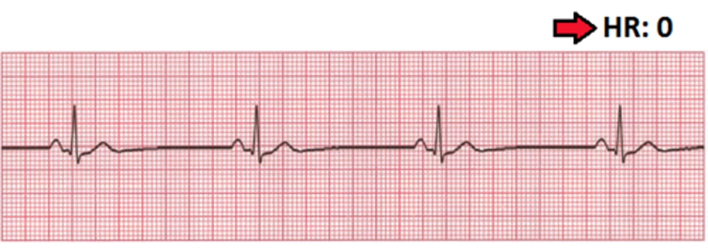 <p>lethal rhythm with no pulse</p><p>CPR and epi</p>