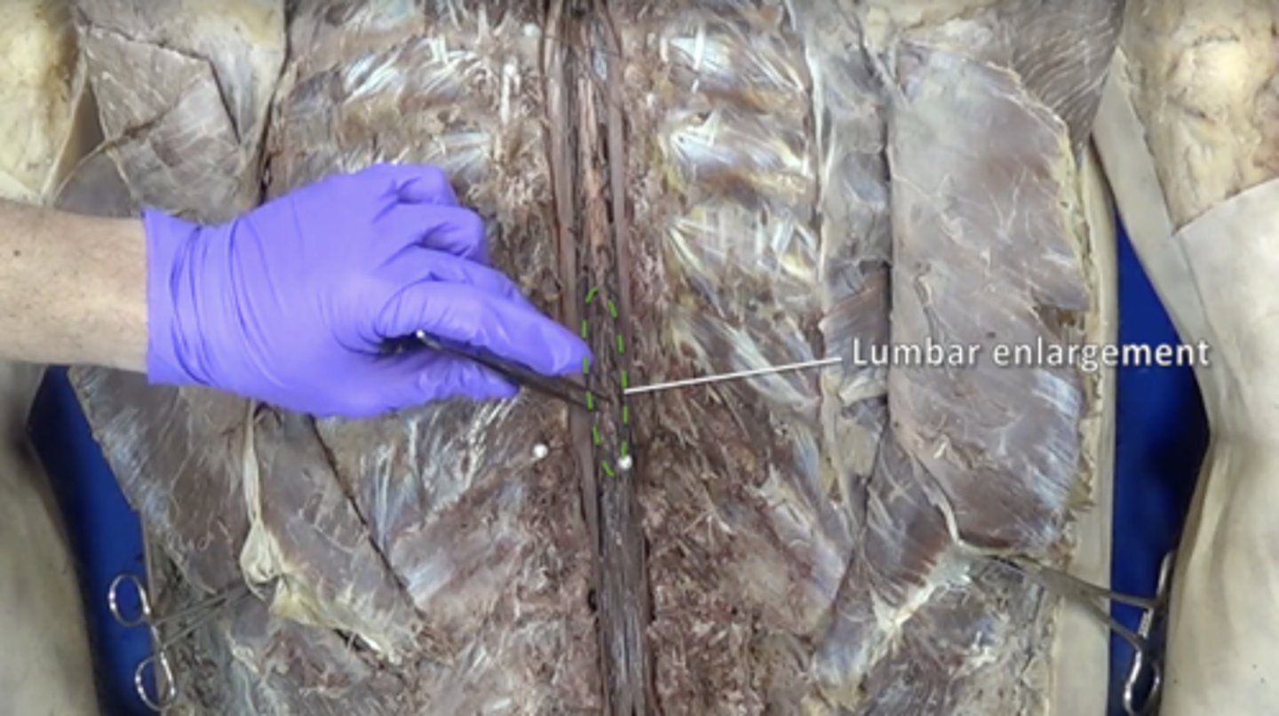 <p>nerves of pelvis and lower limbs</p>