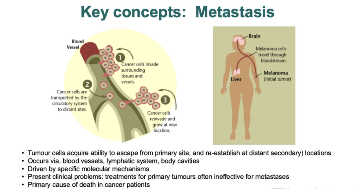 <ul><li><p>tumor cells can escape from primary site and re establish ar a distant secondary location(s)</p></li><li><p>by blood vessels, lymphatic system and body cavities </p></li><li><p>primary cause of death in cancer patients </p></li></ul><p><span style="background-color: inherit; line-height: 22px; color: windowtext;"><span>Dependent on the individual cancer where the metastasis ends up</span></span><span style="line-height: 22px; color: windowtext;"><span>&nbsp;</span></span></p><ul><li><p class="Paragraph SCXO85088935 BCX0" style="text-align: left;"><span style="background-color: inherit; line-height: 22px; color: windowtext;"><span>But some commonly go to certain places e.g. initial melanoma tumour often travel to the brain&nbsp;</span></span><span style="line-height: 22px; color: windowtext;"><span>&nbsp;</span></span></p></li></ul><p class="Paragraph SCXO85088935 BCX0" style="text-align: left;"><span style="background-color: inherit; line-height: 22px; color: windowtext;"><span>Harder to treat after metastasis</span></span><span style="line-height: 22px; color: windowtext;"><span>&nbsp;</span></span></p>