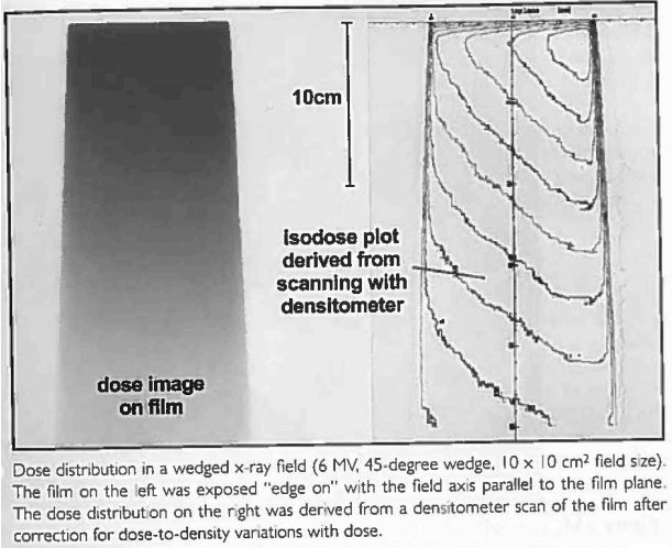 <p>Isocurves for dose distribution with wedges</p>
