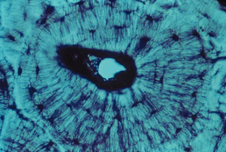 <p>Lamellae connects via </p>