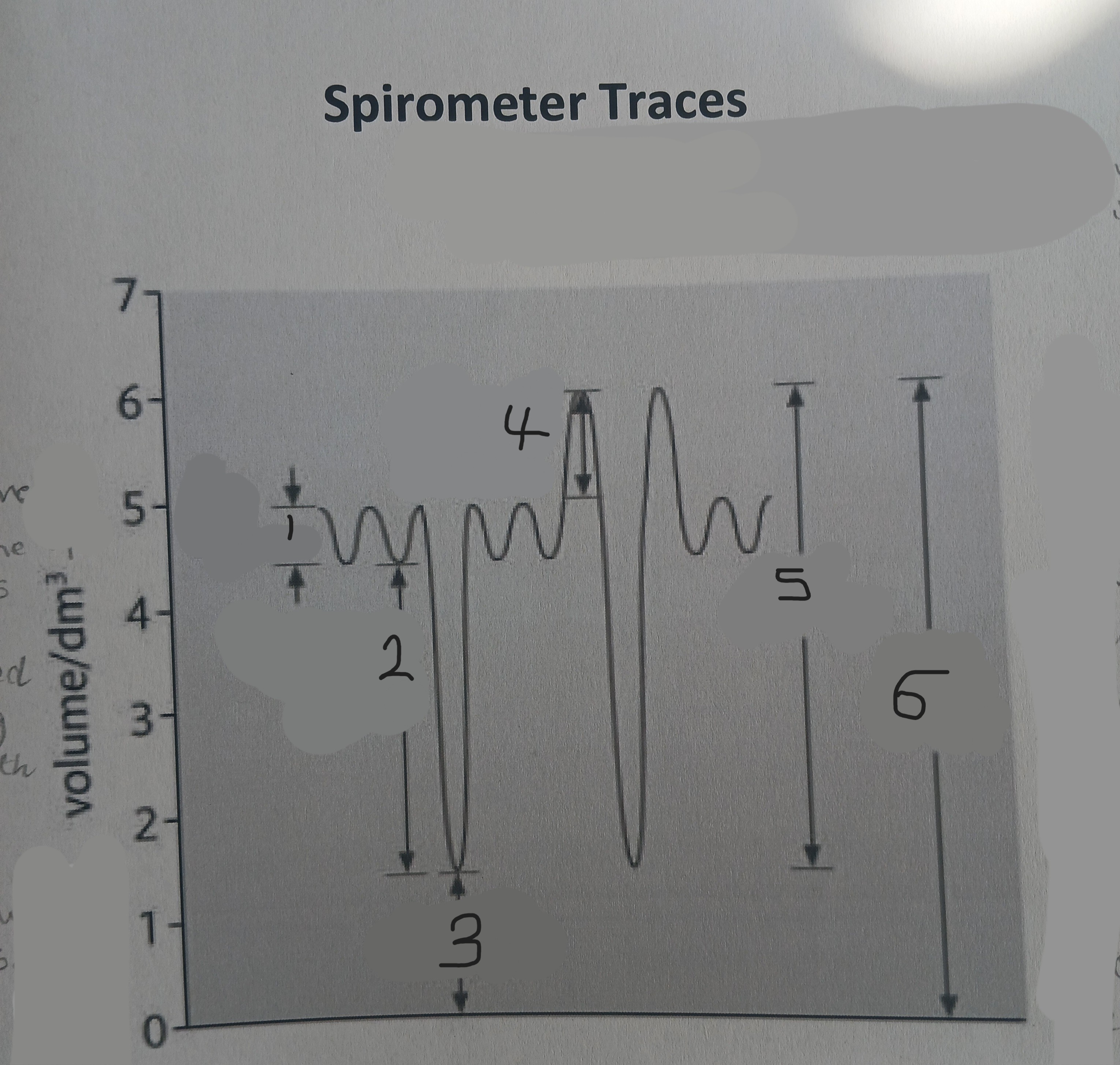 <p>What is number 4?</p>