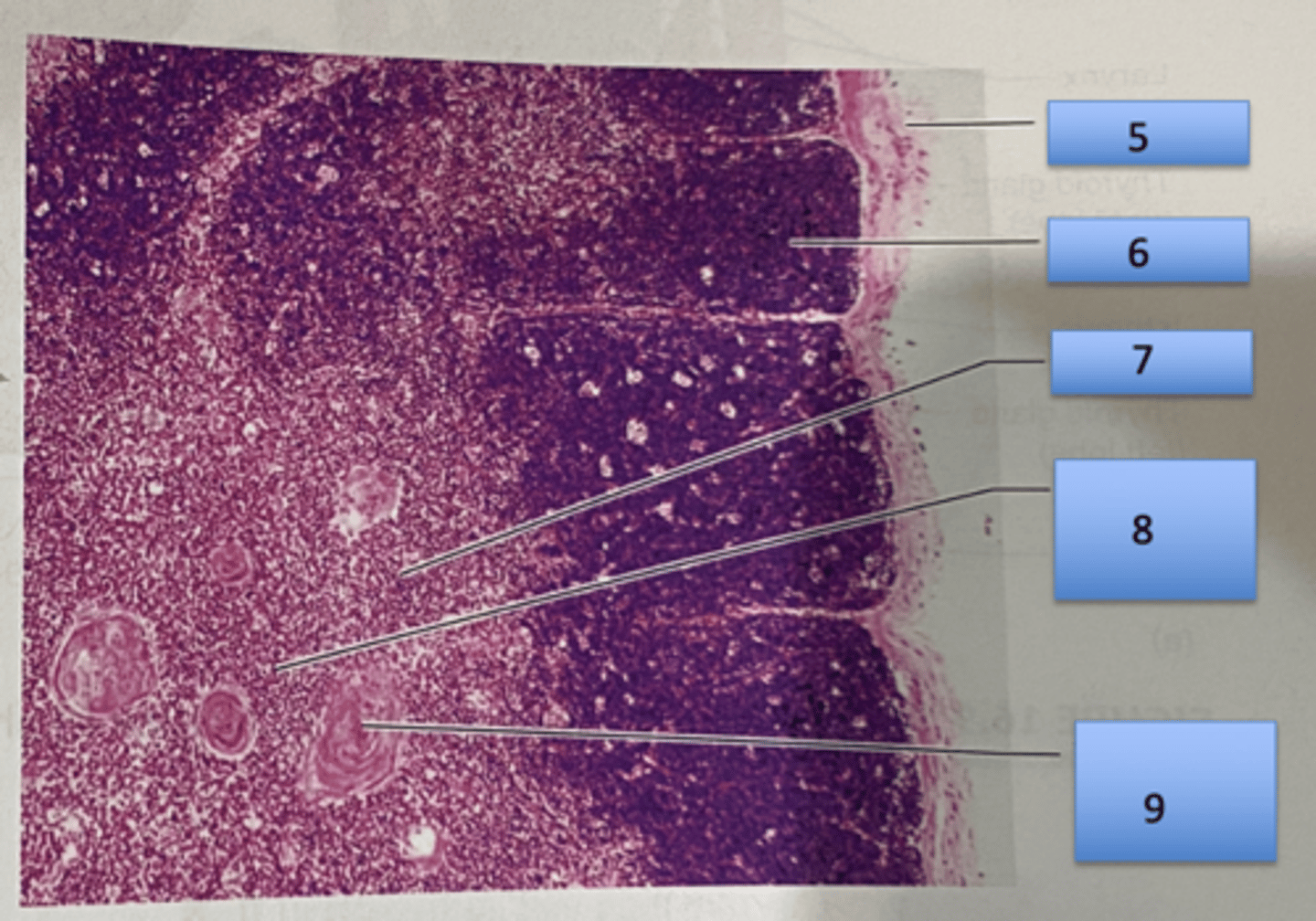 <p>Thymus</p><p>5. Capsule</p><p>6. Cortex</p><p>7. medulla</p><p>8. Epithelial reticular cells</p><p>9. Thymic corpuscle</p>