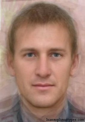<p>Identify this Phenotype</p>
