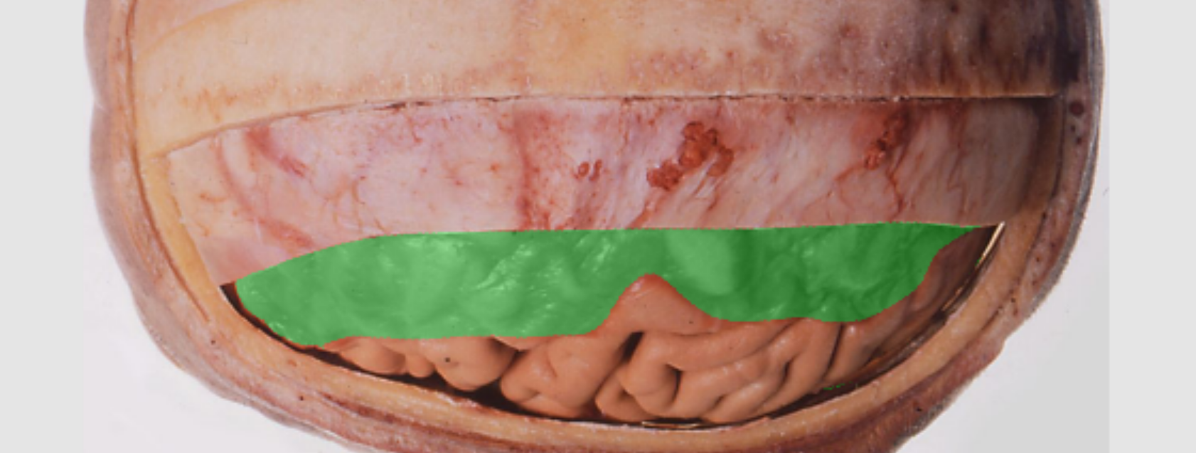 <p>What meninges layer is these?</p>