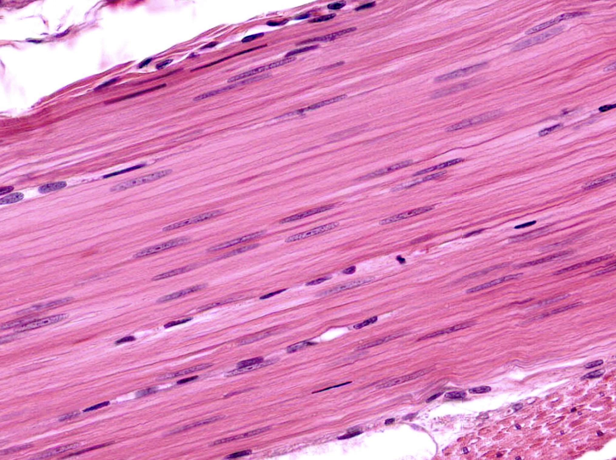 <p>What type of tissue is this?</p>