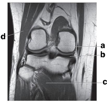 <p><span><span>What is letter b?</span></span></p>