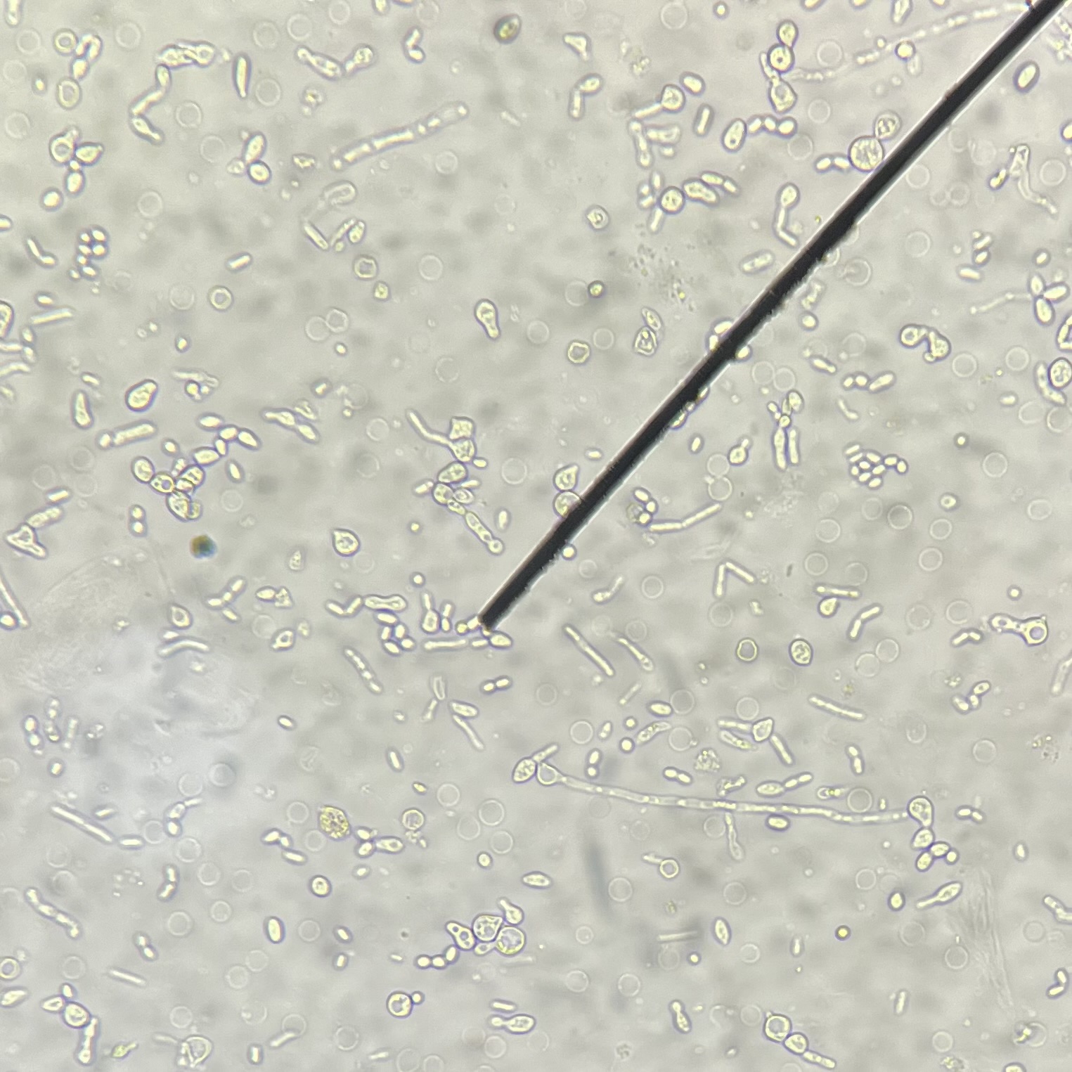 <ol><li><p>Identify pointed structure.</p></li><li><p>What primary infects patient with this structure?</p></li></ol><p></p>