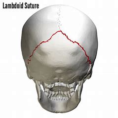 <p>what suture is this?</p>