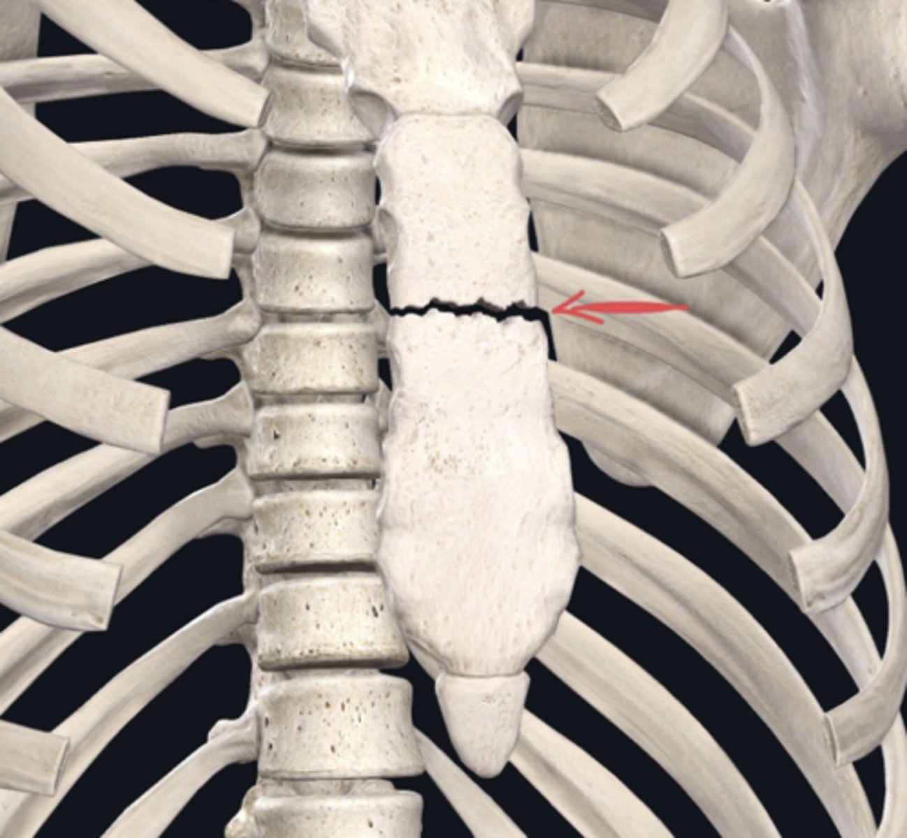 <p>Identify the plane of section in which the indicated fracture has occurred. (Free response)</p>