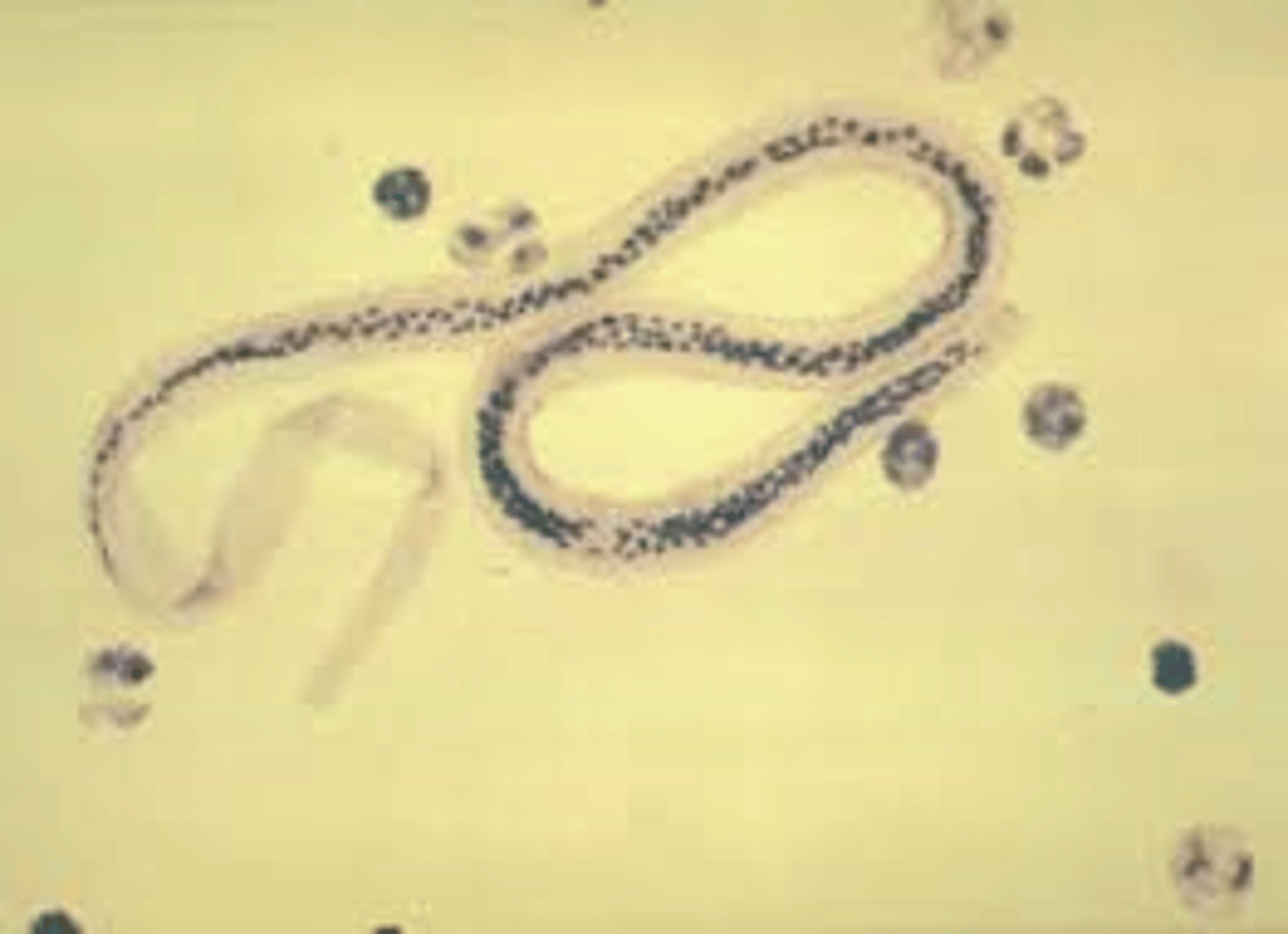 <p>230-300um</p><p>Sheath</p><p>No terminal nuclei</p><p>Short cephalic space</p>