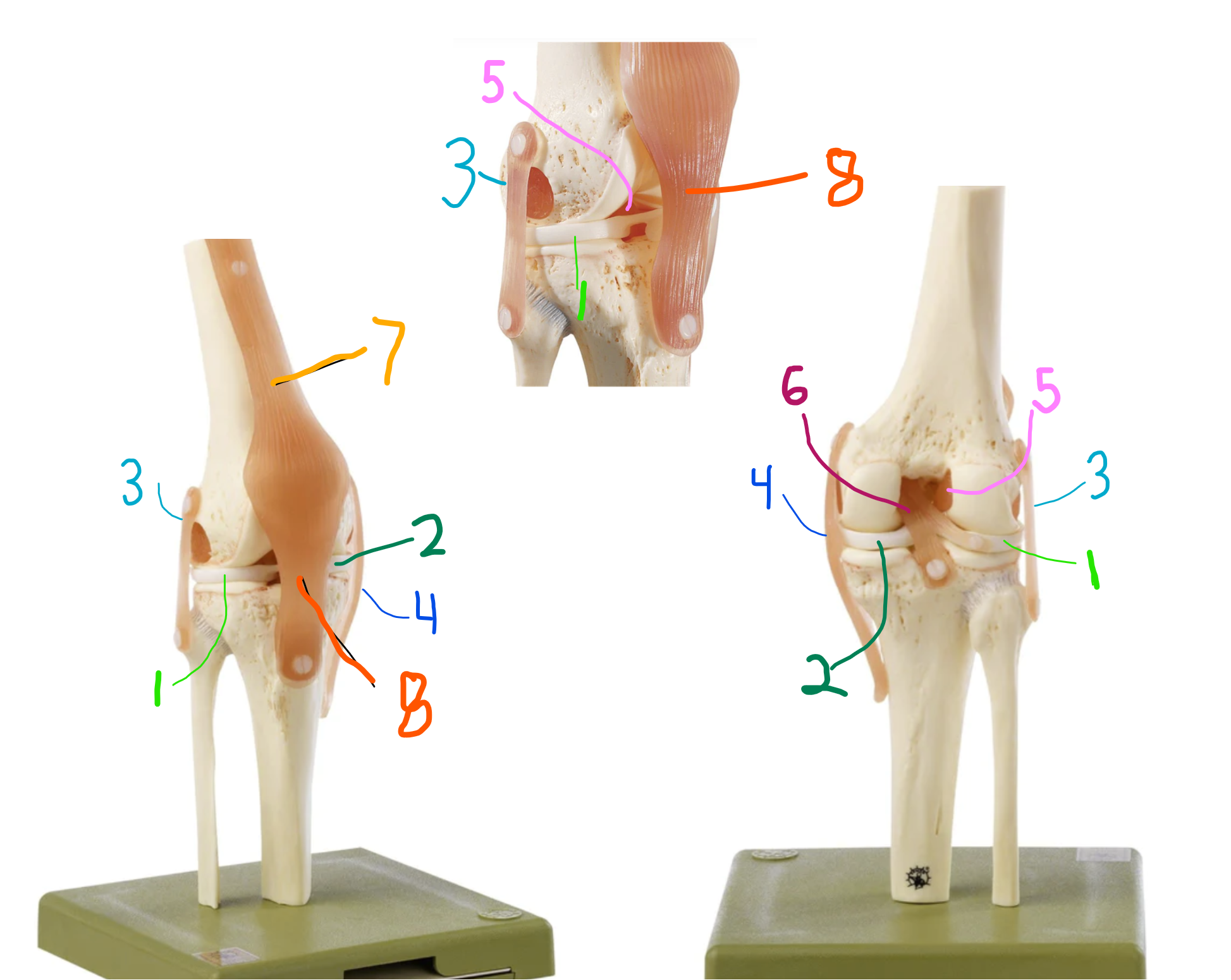 <p>what joint is this</p>