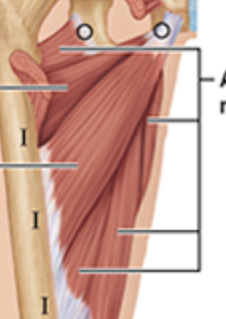 <p>below and behind adductor longus</p>