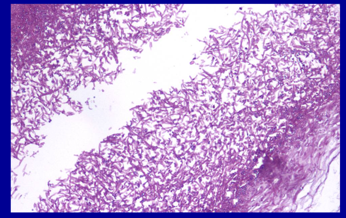 <p>ID the stain type </p>