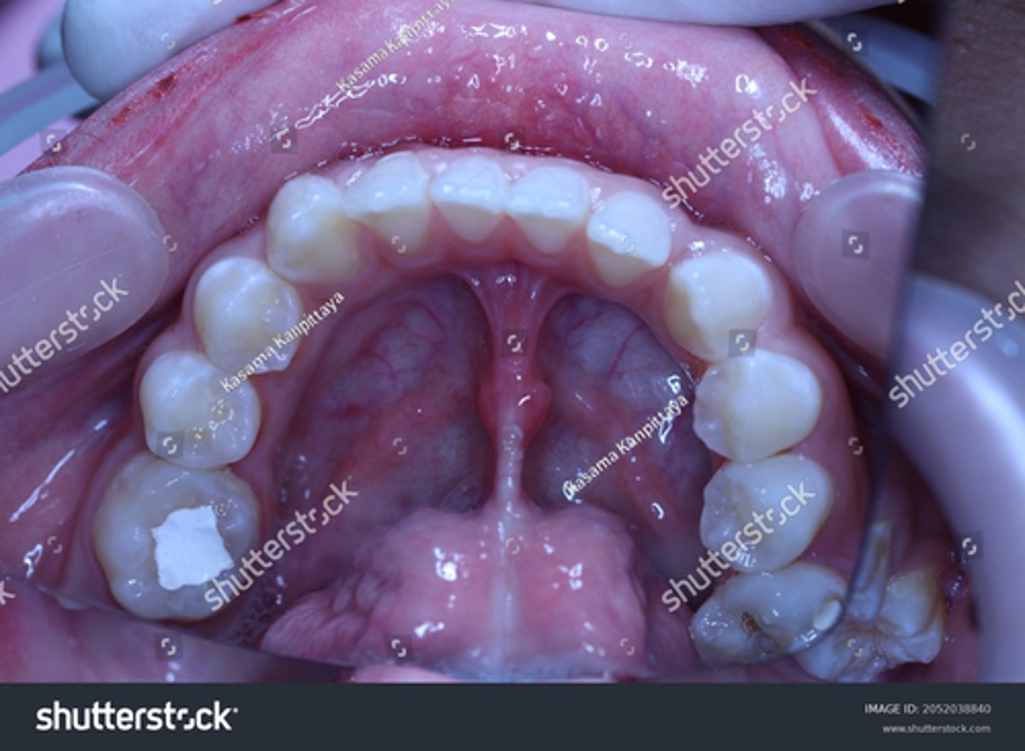 <p>IRM is made of _______</p>