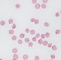 <p><span>Anaplasmosis</span></p>