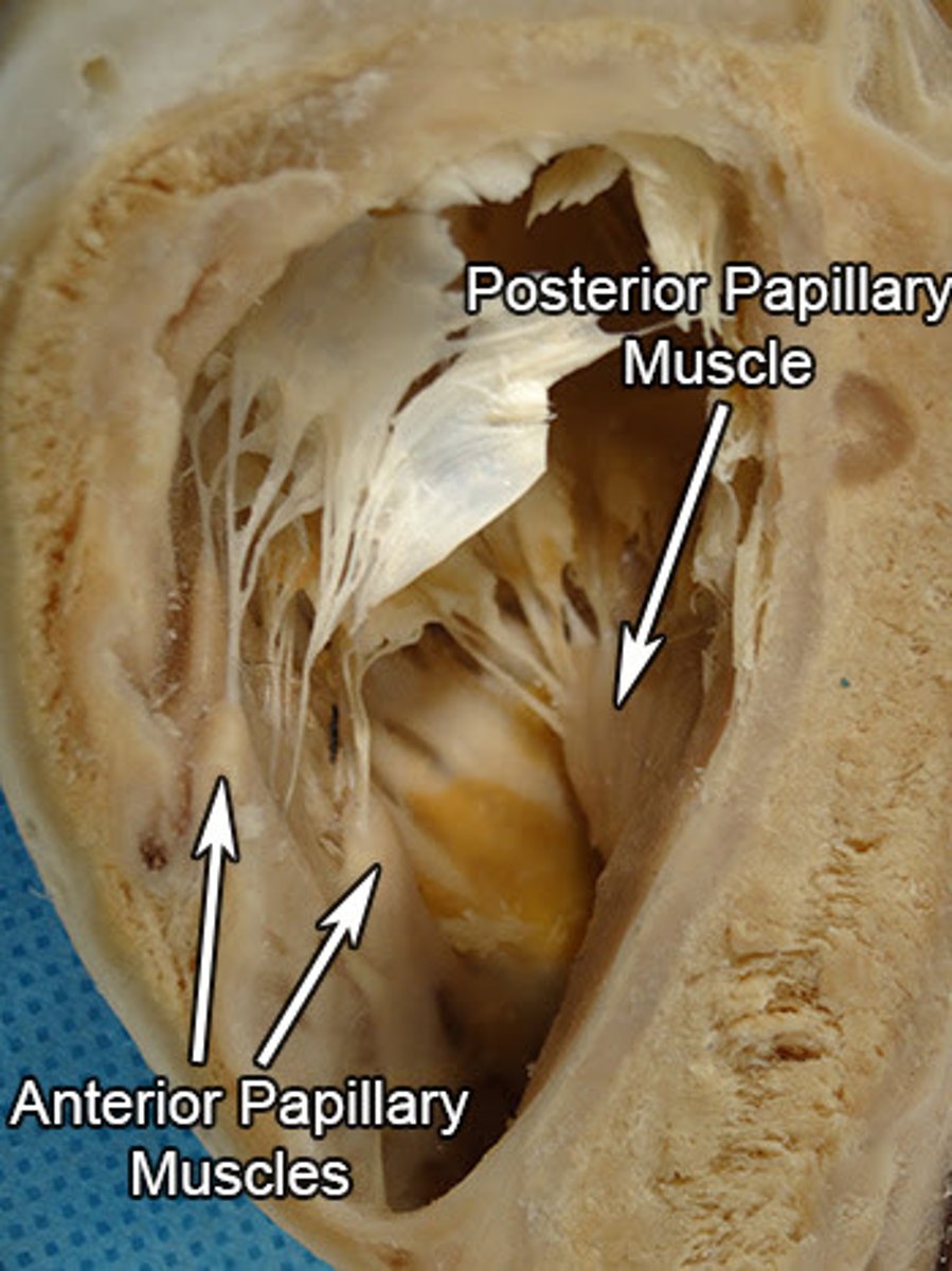 <p>arises from inferior wall and attaches to posterior and septal cusps</p>