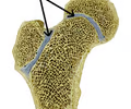 cartilaginous joint that is immovable
