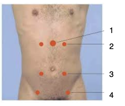 <p><span>What artery is each line pointing to in this picture?</span></p><p></p>