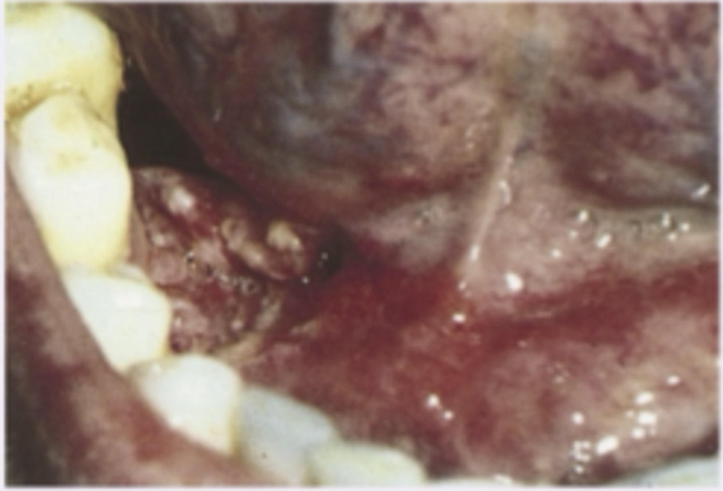 <p>Diagnosis?</p>