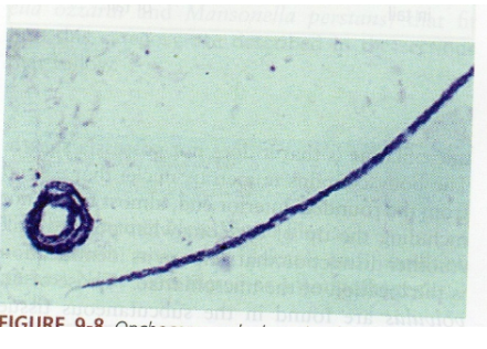 <p>What is the vector for Onchocerca volvulus?</p>