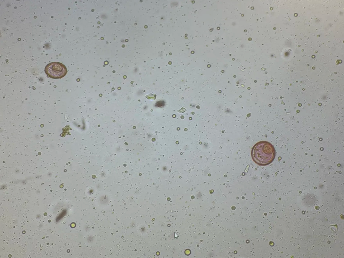 <p>fecal sample from human</p>