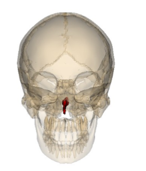 <p>Which facial bone is this? (1)</p>