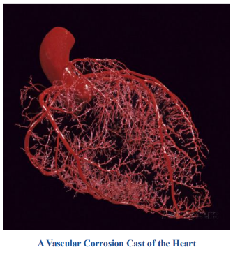 <p>-anastomotic connections between the territories by branches of the right and left coronary arteries typically minimal</p><p>-coronary arteries described as being functional end arteries; true end arteries are the only blood supply to a region</p><p>-blockages may be asymptomatic, cause angina pectoris with transient pain, or a myocardial infarction where there is prolonged pain and possibly permanent damage to heart muscle</p>