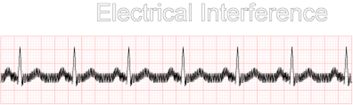 <p>Inspect electrodes and wires for secure connection</p>