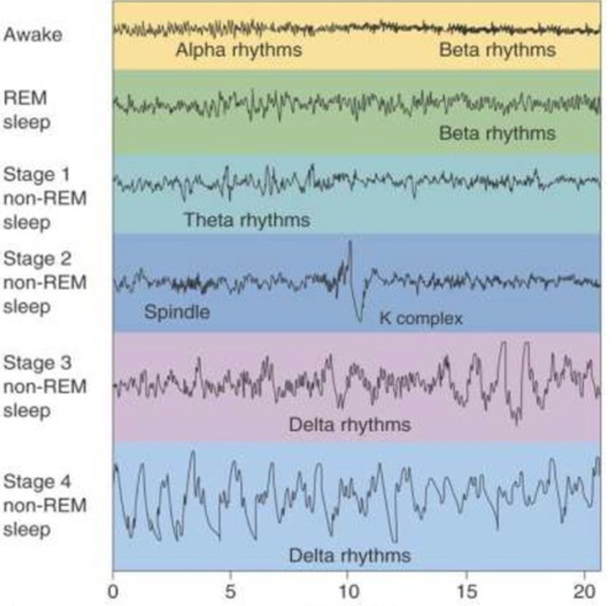 <p>deep sleep; stages 3 &amp; 4 marked by delta waves.</p>