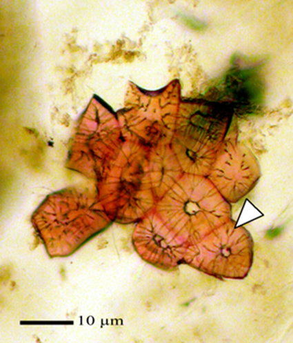Sclereids in pear fruit