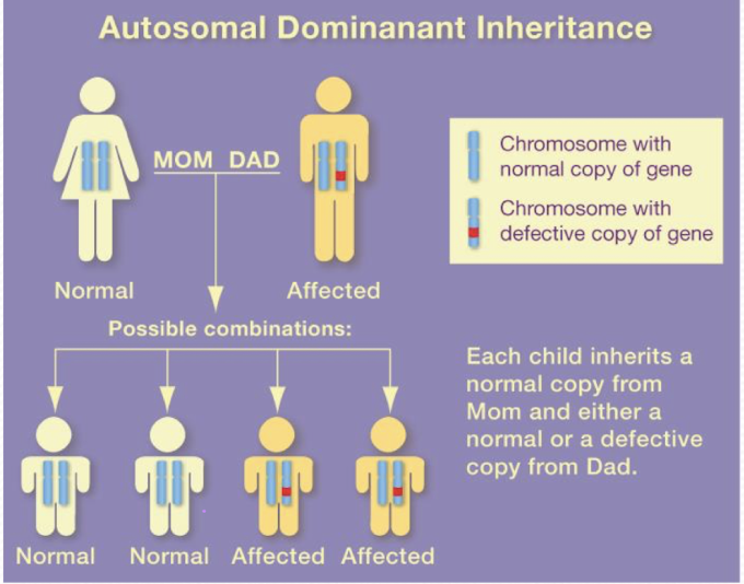 <ul><li><p><span style="background-color: transparent; font-family: "Times New Roman", serif;"><span>Multigenerational </span></span></p></li><li><p><span style="background-color: transparent; font-family: "Times New Roman", serif;"><span>50% change of passing on gene </span></span></p></li><li><p><span style="background-color: transparent; font-family: "Times New Roman", serif;"><strong><span>Males and females EQUALLY affected </span></strong></span></p></li><li><p><span style="background-color: transparent; font-family: "Times New Roman", serif;"><span>Varying degrees of presentation </span></span></p></li><li><p><span style="background-color: transparent; font-family: "Times New Roman", serif;"><span>Ex: Huntington’s, Achondroplasia (dwarfism) </span></span></p></li></ul><p></p>