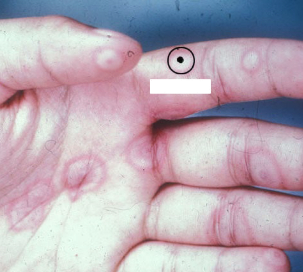 <p>what shape/arrangement and condition is depicted</p>