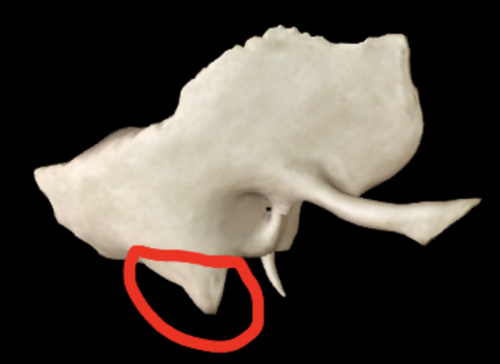 <p>What part of the temporal bone is this?</p>