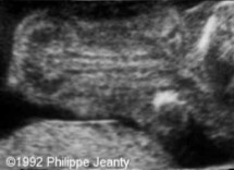 <ol><li><p>What is abnormal about this image?</p></li><li><p>This finding can be associated with what pathologies?</p></li></ol><p></p>