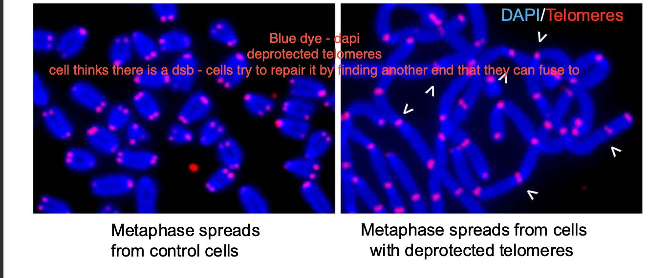 <p>-<strong>Mis repair of damage </strong>-especially DNA DOUBLE STRAND BREAKS, can be recombination errors / replication errors.</p><p></p><p>Shelterin - telomerase protection the ends of chromosomes - prevents them from being recognised as a double strand break - prevent INAPPROPRIATE DNA damage response. (deletions, duplications, inversions) inappropriate recombination - during meiosis</p><p></p><p>Without telomeres - ends of chromosomes are TREATED as double strand breaks</p><p>telomeres - crucial protection + stability of the chromosome</p>