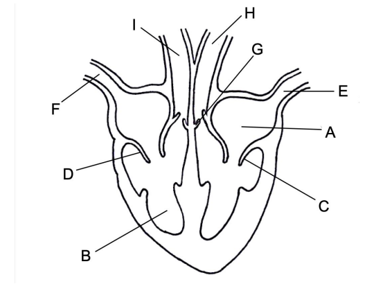<p>label this image</p>