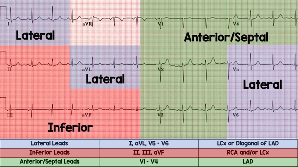 <p>2 or more leads which look at same area of heart</p><p>-V1-V4</p><p>-II, III, aVF</p><p>-I, aVL, V5, V6</p>