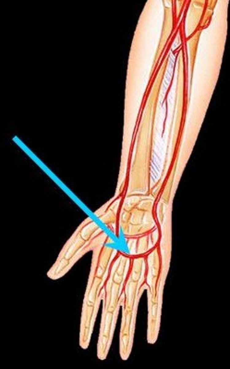 <p>Identify the vessel (include artery vs vein)</p>