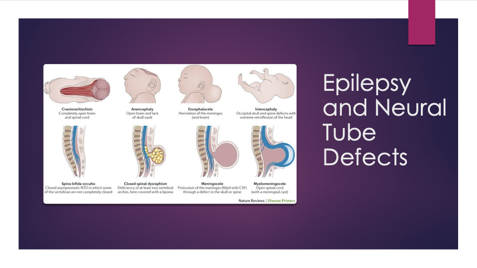 <p>Neural tube defects</p><p><span style="font-family: &quot;Wingdings 3&quot;">u</span><span style="font-family: &quot;Century Gothic&quot;">low-set ears</span></p><p><span style="font-family: &quot;Wingdings 3&quot;">u</span><span>&nbsp; </span><span style="font-family: &quot;Century Gothic&quot;">broad nasal bridge</span></p><p><span style="font-family: &quot;Wingdings 3&quot;">u</span><span>&nbsp; </span><span style="font-family: &quot;Century Gothic&quot;">irregular teeth</span></p><p><span style="font-family: &quot;Wingdings 3&quot;">u</span><span>&nbsp; </span><span style="font-family: &quot;Century Gothic&quot;">hypoplastic nails and digits</span></p><p></p>