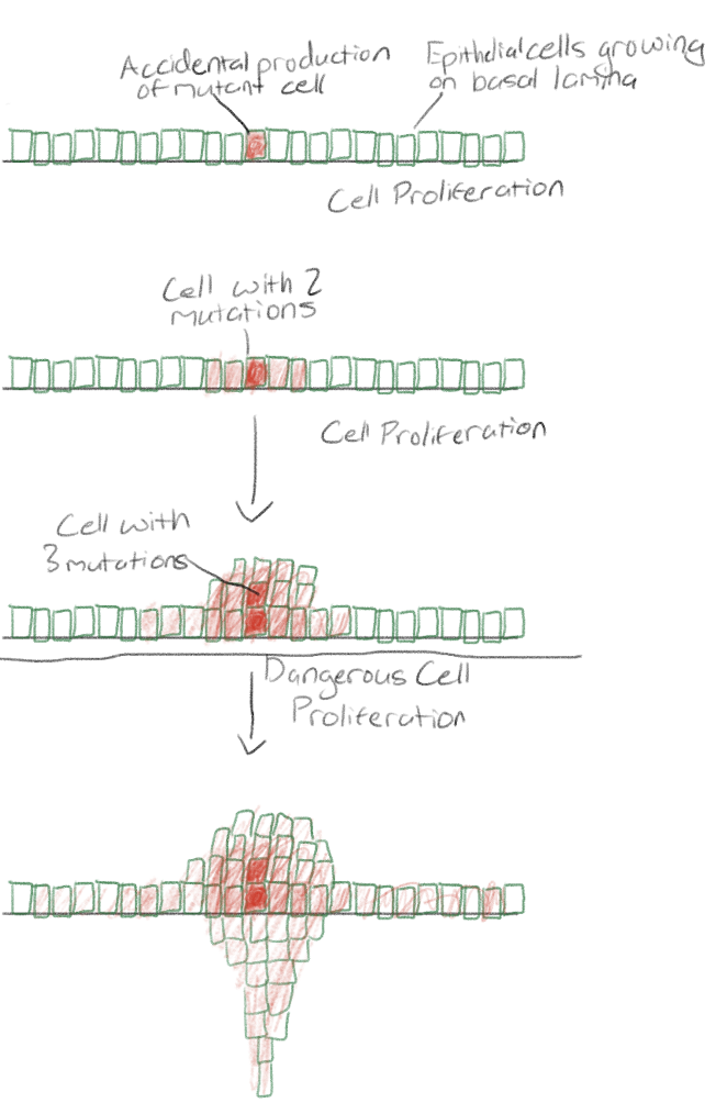 <p>Abnormal cells invade surrounding tissue</p>