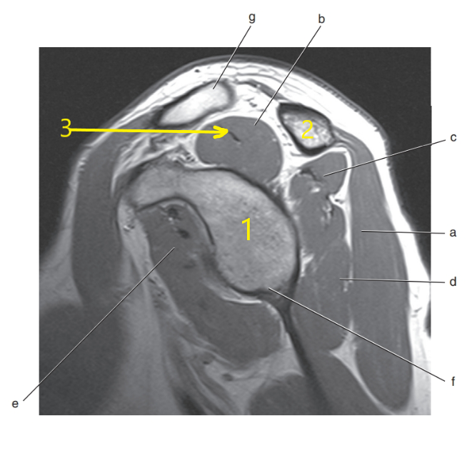 <p>What is # 2 ?</p>