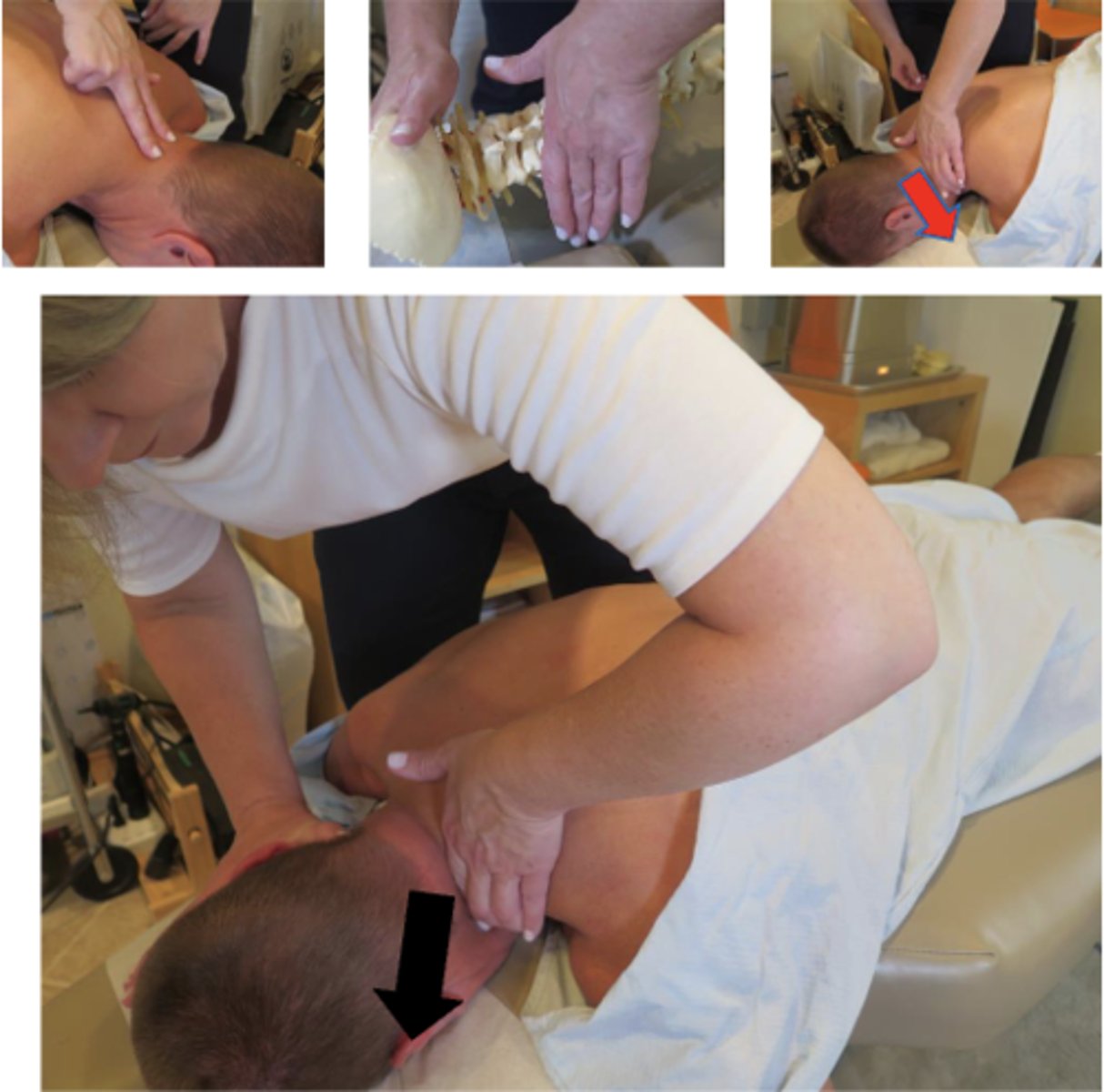 <p>• PP: Prone, asks permission to open gown/contact patient, verbalize finding the segment</p><p>• DP: fencer stance, facing cephalad EITHER side of contact, tissue slack M-L</p><p>• CH: Index on posterolateral aspect of superior articular pillar, on the side of rotation, fingers pointing down and thumb on posterior neck</p><p>• IH: #3, thumb under occiput, fingers along face/head opposite side of contact (distract and rotate head to side of contact)</p><p>• Vec: P-A and I-S</p><p>**P-A and S-I for lateral flexion malposition (closing thewedge)</p>