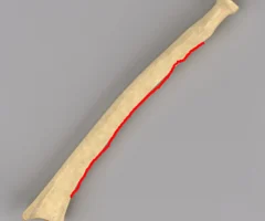 sharp medial edge of shaft