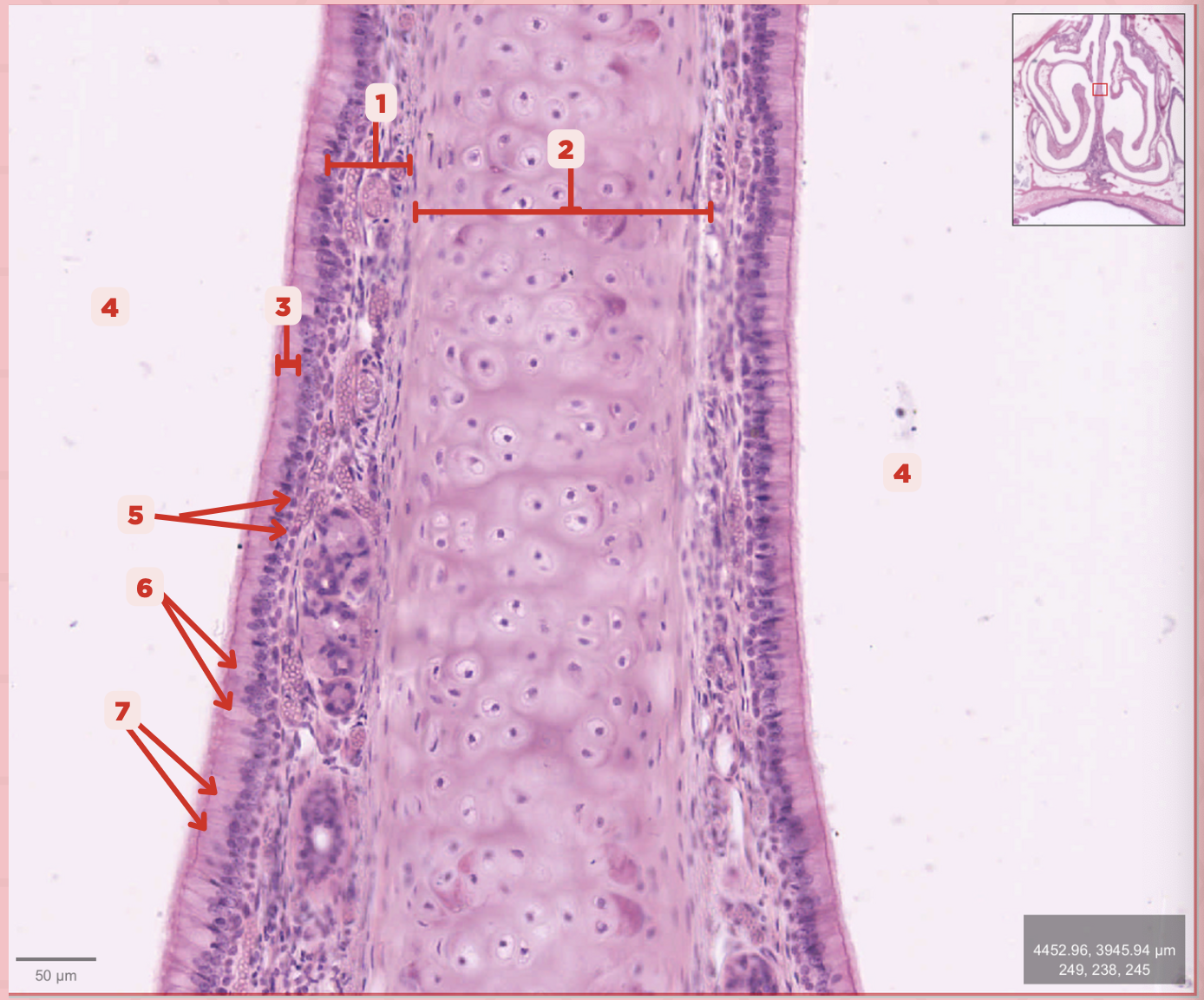 <p>What type of cells make up #1?</p>