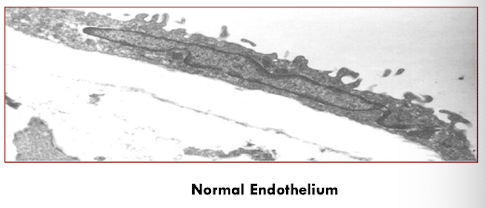 <p>smooth, non-turbulent blood flow</p><p>vasodilation, antithrombotic &amp; profibrinolytic (prevent clotting)</p>