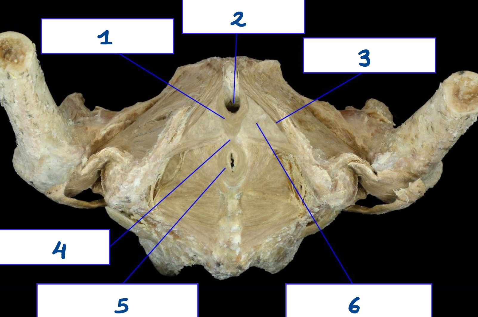 <p>What is structure 2?</p>